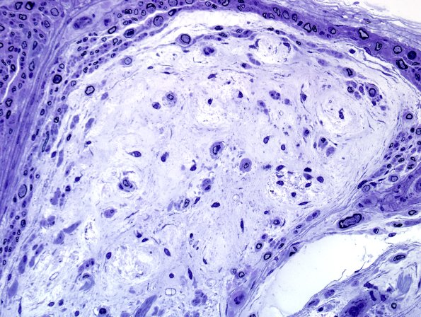 5F5 Renaut body-oma (Case 5) Plastic 16.jpg