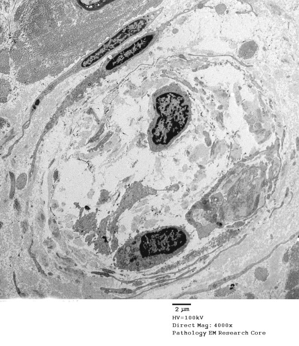 5G1 (Case 5) EM 030 - Copy