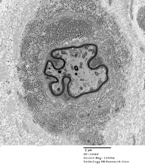 5G11 Renaut body-oma (Case 5) EM 046A - Copy