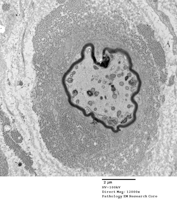 5G12 Renaut body-oma (Case 5) EM 037A - Copy