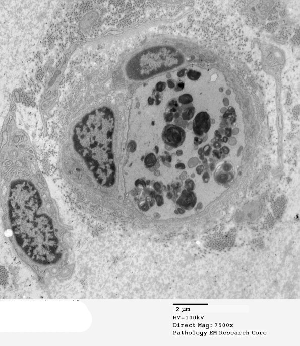 5G13 Renaut body-oma (Case 5) EM 004A - Copy