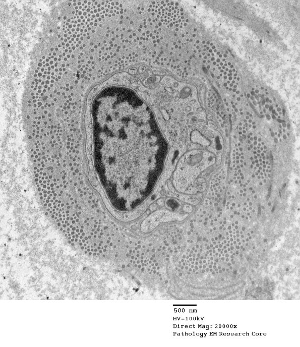 5G14 Renaut body-oma (Case 5) EM 038A - Copy