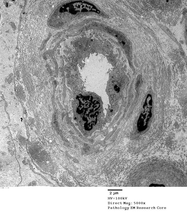 5G15 Renaut body-oma (Case 5) EM 017A - Copy