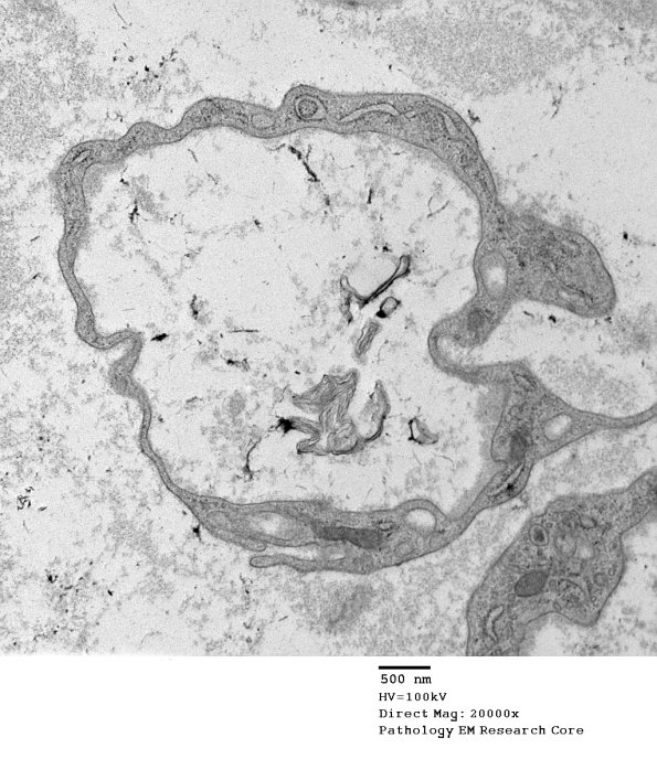 5G3 Renaut body-oma (Case 5) EM 040A - Copy