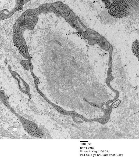 5G4 Renaut body-oma (Case 5) EM 039A - Copy