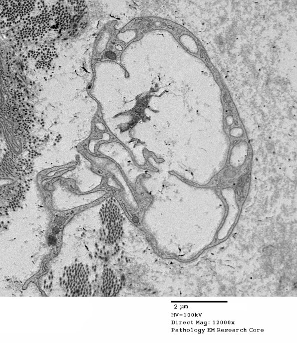 5G5 Renaut body-oma (Case 5) EM 051A - Copy