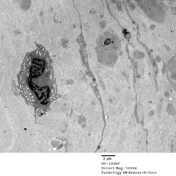 5G7 Renaut body-oma (Case 5) EM 018A - Copy