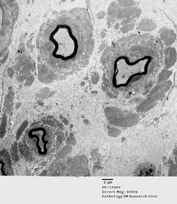 5G9 Renaut body-oma (Case 5) EM 028A - Copy