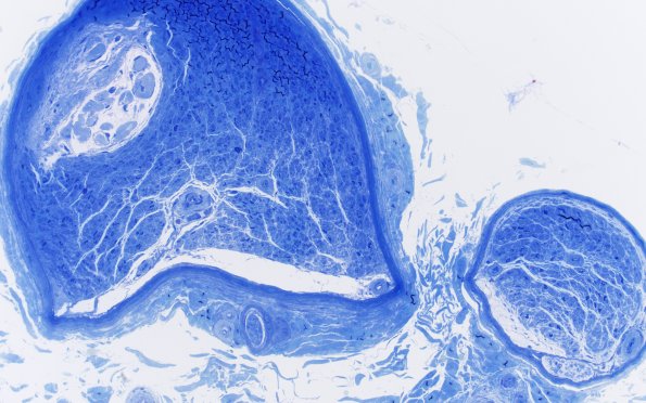 7A1 Renaut body (Case 7) Plastic 20X 1