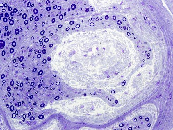 8A2 Renaut bodies (Case 8) Plastic 5.jpg