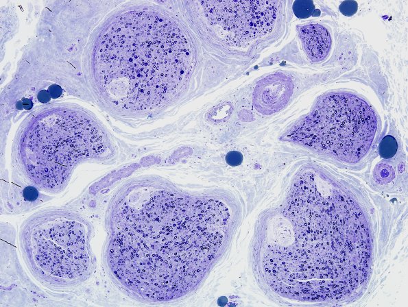 9A1 Renaut Bodies (Case 9) Plastic 1