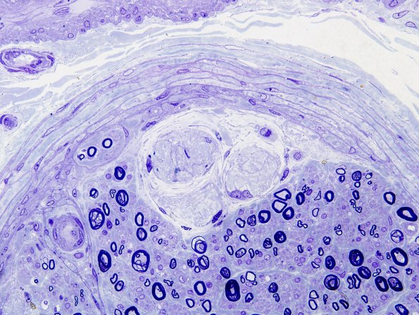 9A2 Renaut Bodies (Case 9) Plastic 5