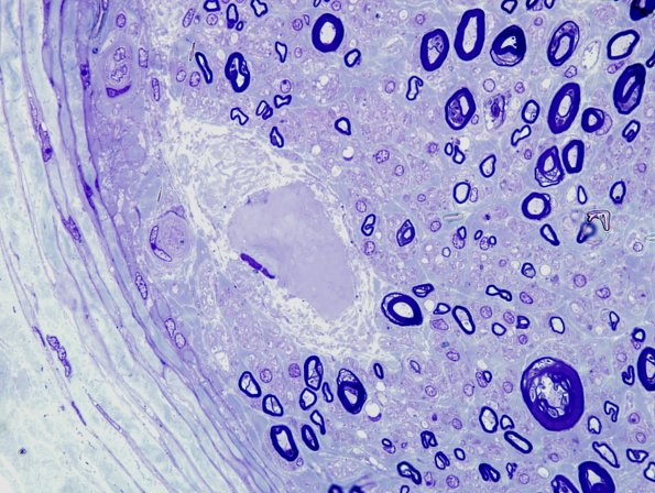 9A3 Renaut Bodies (Case 9) Plastic 6