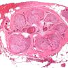 1 Routine H&E Histology