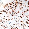 1B6 Nerve fibers (Case 3) CD56 IHC NCAM 60X