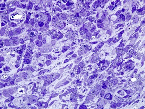 1C2B (Case 1) 100X Plastic 16