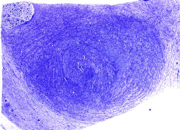 1C6A (Case 1) Plastic 26