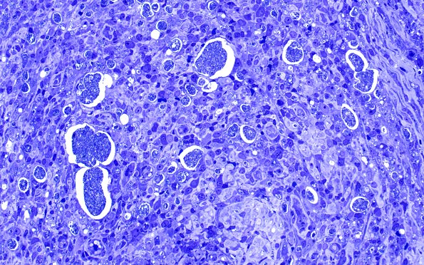 1C6B (Case 1) Plastic 26 40X