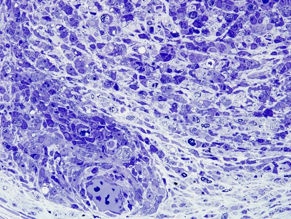 1C7C  (Case 1) Plastic 5