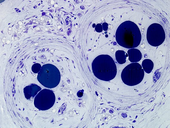 4B5 (Case 4) Plastic 7