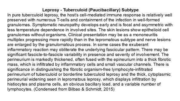 0A2 Leprosy, Tuberculoid - Text