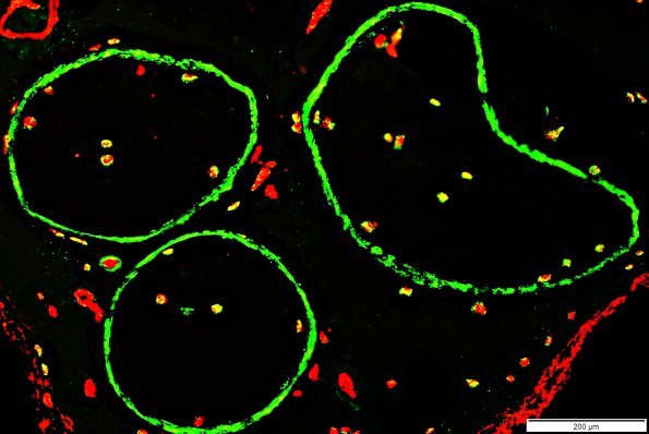 0A2 hiemc5gulexr - Copy