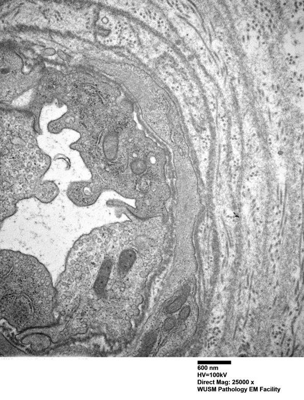 13C3 (Case 13) EM025 - Copy