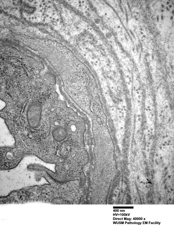 13C4 (Case 13) EM026 - Copy