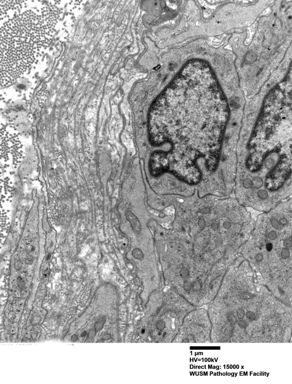 15B2 (Case 15) HIEM EM 003 - Copy