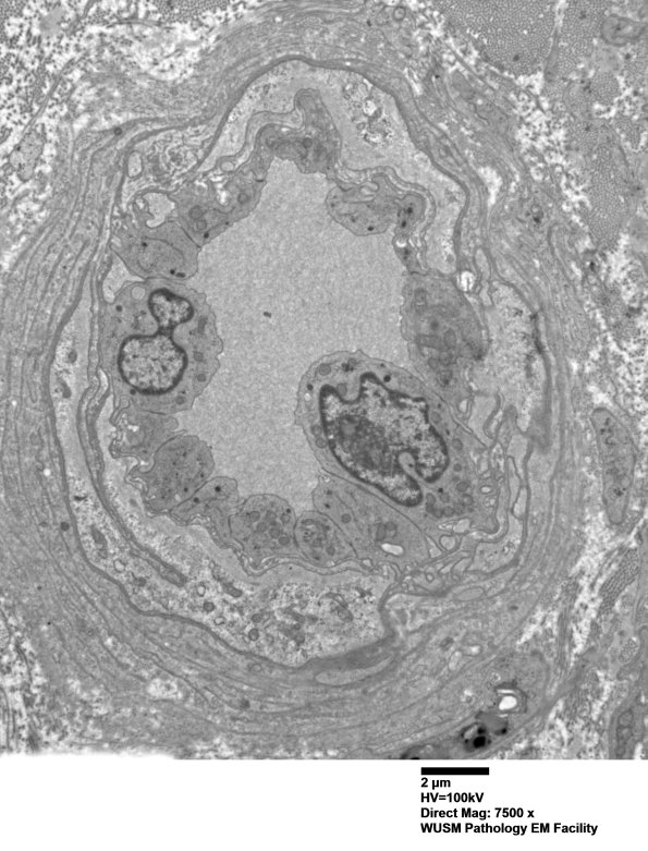 15B3 (Case 15) HIEM EM 006 - Copy