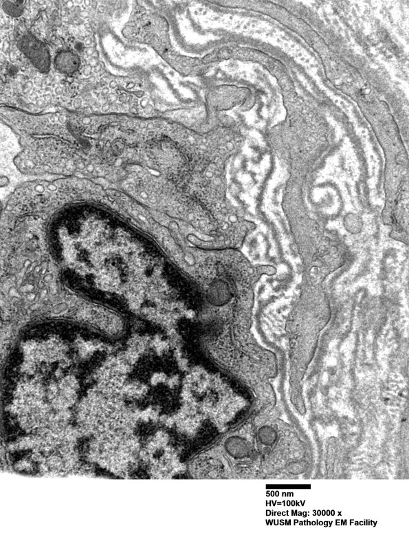 16B10 (Case 16) HIEM EM031 - Copy