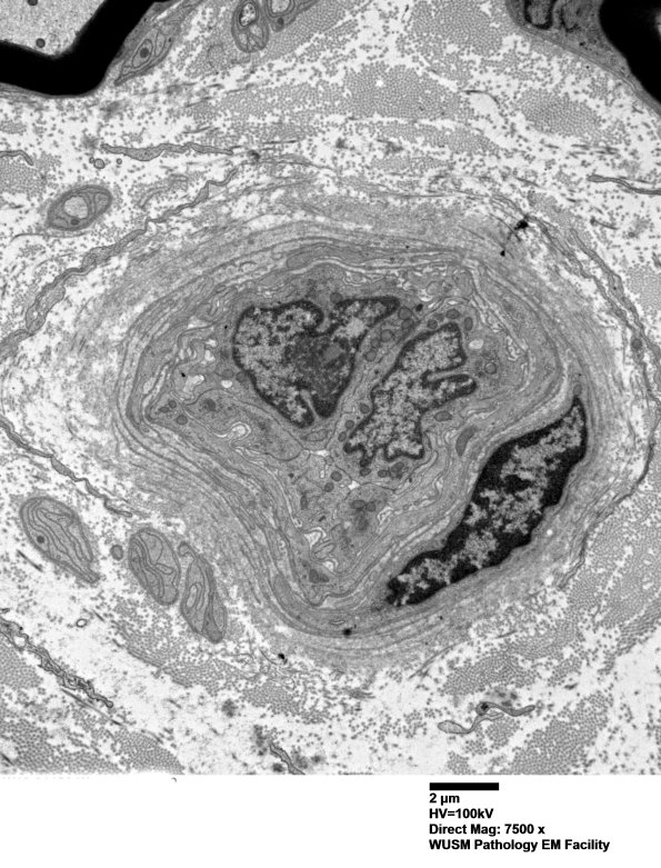 16B4 (Case 16) HIEM EM019 - Copy