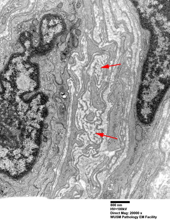 16B8 (Case 16) HIEM EM027 - Copy copy