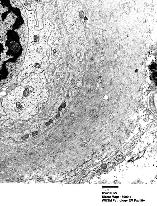 5C2 (Case 5) EM016 - Copy