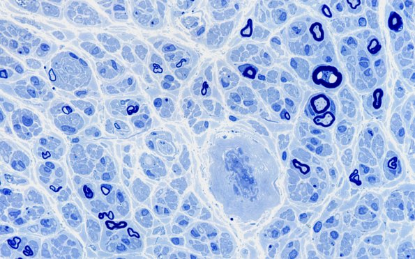 6B6 (Case 6) Plastic 100X 4