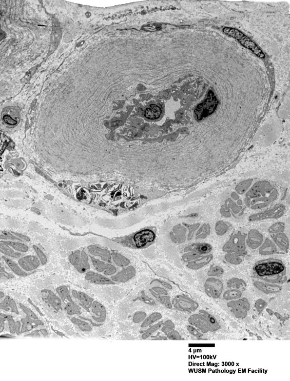 6C1 (Case 6) EM 001 - Copy