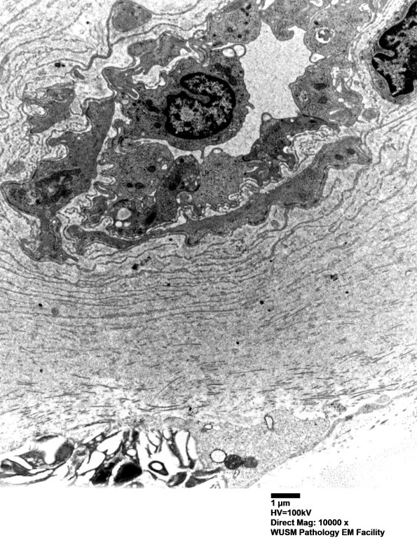 6C2 (Case 6) EM 003 - Copy