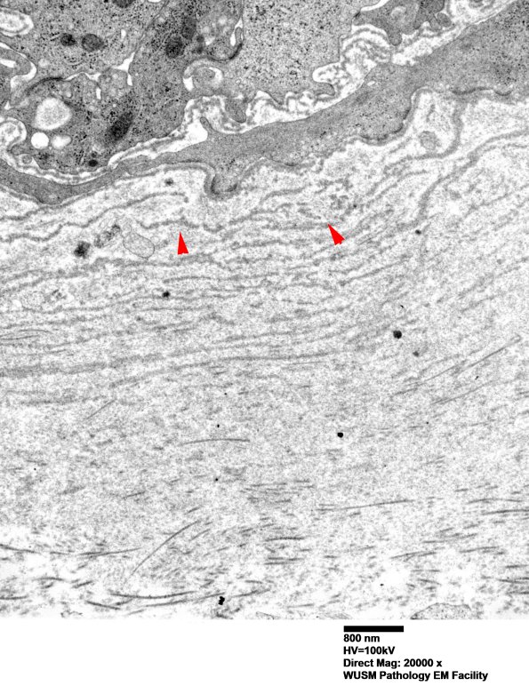 6C3 (Case 6) EM 004 - Copy copy