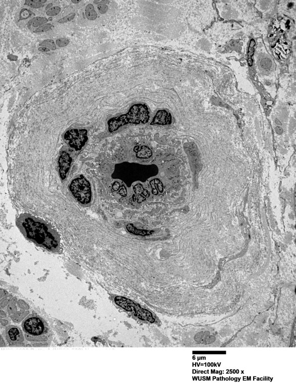 6C4 (Case 6) EM 013 - Copy