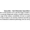 0A Vasculitis-NOS Text