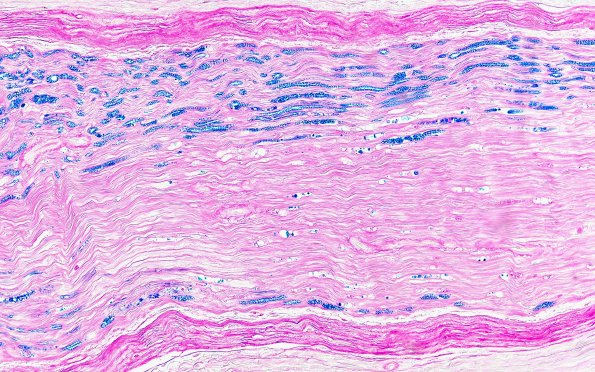 2B4 (Case 2) LFB 20X 3A