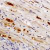 4B5-Vasculitis-Case-4B-NF-11.jpg