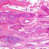 9A1-Vasculitis-Case-9A-6B.jpg