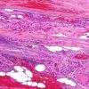 9B-Vasculitis-Case-9B-3.jpg