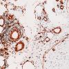 4B2 Vasculitis, Churg-Strauss (Case 4) SMA 20X 1