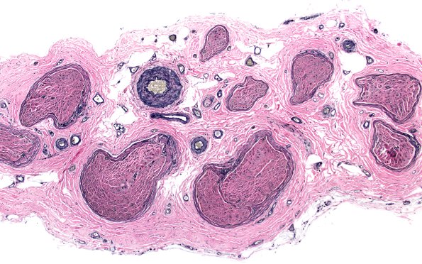 10A1 Elastin (Case 10) 10X