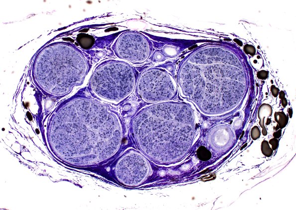 16A1 (Case 16) Plastic 4X