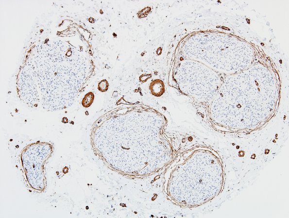 4A1 Nerve, vasculature (Case 4) SMA 1