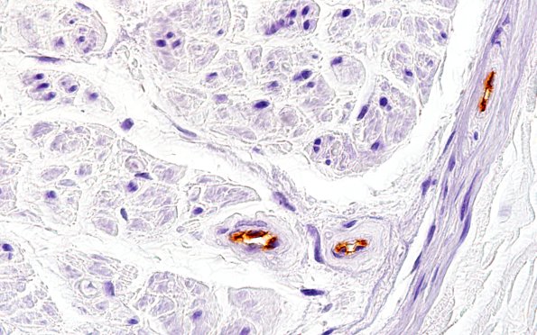 6A7 Ulex (Case 6) 100X 1