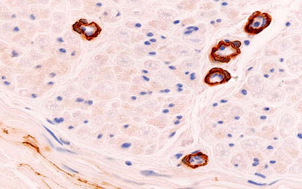 8A4 (Case 8) SMA 100X 2